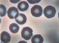 healthy spacing between red blood cells